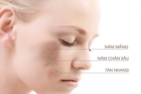 Tác hại của việc không bôi kem chống nắng? Ảnh hưởng thế nào đến làn da của bạn